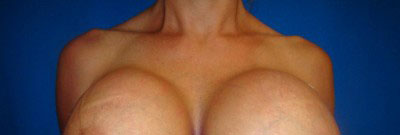 breasts-heavy-nottom-lighting-400